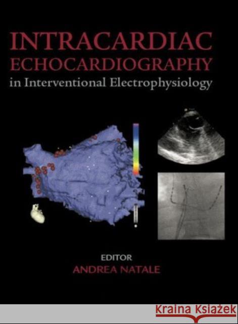 Intracardiac Echocardiography in Interventional Electrophysiology: Advanced Management of Atrial Fibrillation and Ventricular Tachycardia Natale, Andrea 9781842143100 Informa Healthcare