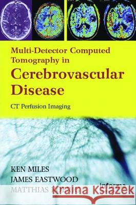 Multidetector Computed Tomography in Cerebrovascular Disease: CT Perfusion Imaging Kenneth Miles James D. Eastwood Matthias Konig 9781842143155