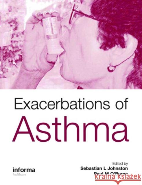 Exacerbations of Asthma Sebastian L. Johnston Paul M. O'Byrne 9781842143186 Informa Healthcare