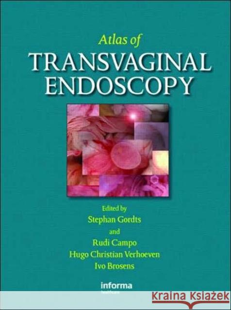 Atlas of Transvaginal Endoscopy Stephen Gordts Gordts Gordts Ivo Brosens 9781842143209 Informa Healthcare