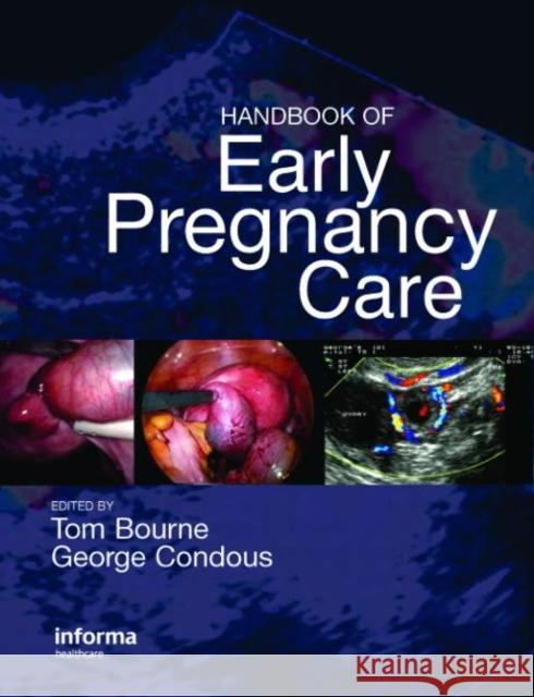 Handbook of Early Pregnancy Care Tom Bourne George Condous 9781842143230 Informa Healthcare