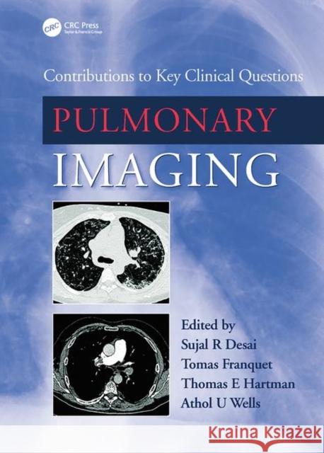 Pulmonary Imaging: Contributions to Key Clinical Questions Desai, Sujal 9781842143247 Informa Healthcare