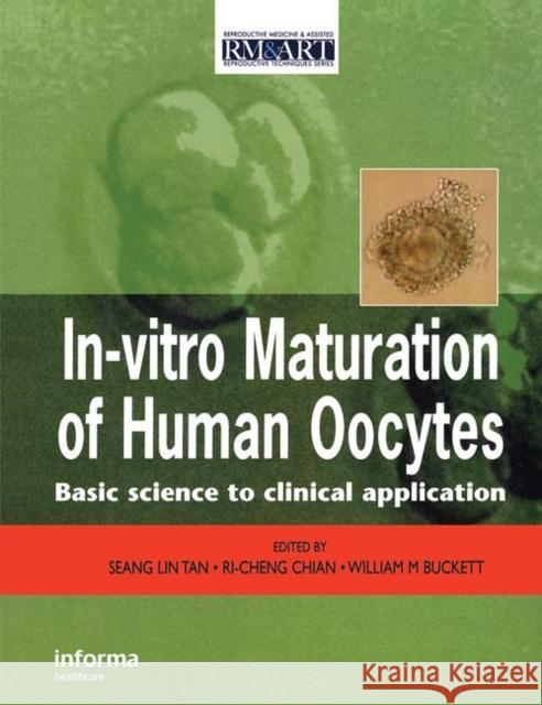 In Vitro Maturation of Human Oocytes Seang Lin Tan Tan Lin Tan Seang Lin Tan 9781842143322