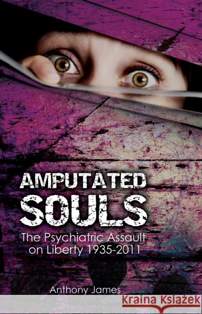 Amputated Souls: The Psychiatric Assault on Liberty 1935-2011 James, Anthony 9781845404505