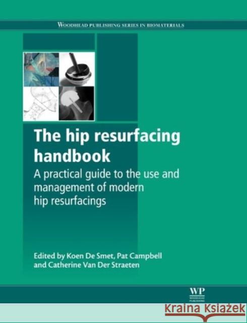 The Hip Resurfacing Handbook: A Practical Guide to the Use and Management of Modern Hip Resurfacings de Smet, K. 9781845699482 Woodhead Publishing