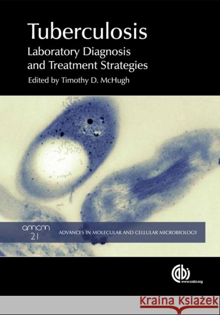 Tuberculosis: Diagnosis and Treatment McHugh, Timothy D. 9781845938079
