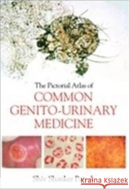 The Pictorial Atlas of Common Genito-Urinary Medicine  9781846194757 Radcliffe Publishing Ltd