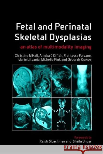 Fetal and Perinatal Skeletal Dysplasias: An Atlas of Multimodality Imaging Hall, Christine M. 9781846194887 0