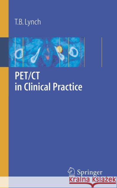 PET/CT in Clinical Practice  Lynch 9781846284304 0