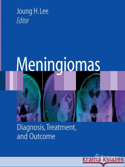Meningiomas: Diagnosis, Treatment, and Outcome Lee, Joung H. 9781846285264