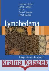 Lymphedema: Diagnosis and Treatment Lawrence L Tretbar, Cheryl L. Morgan, Byung-Boong Lee, Simon J. Simonian, Benoit Blondeau 9781846285486 Springer London Ltd
