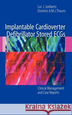 Implantable Cardioverter Defibrillator Stored ECGs: Clinical Management and Case Reports Jordaens, Luc J. 9781846286797 Springer