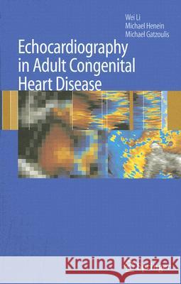 Echocardiography in Adult Congenital Heart Disease Wei Li Michael Henein Michael Gatzoulis 9781846288159 Springer