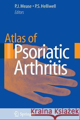 Atlas of Psoriatic Arthritis Philip J., Med Mease Philip S., DM Helliwell 9781846288968 Springer