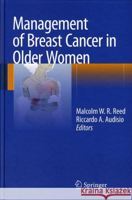 Management of Breast Cancer in Older Women Malcolm W. Reed Riccardo A. Audisio 9781848002647