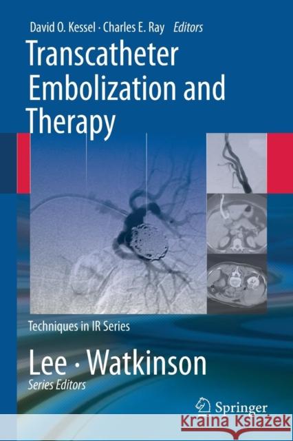 Transcatheter Embolization and Therapy David Kessel 9781848008960