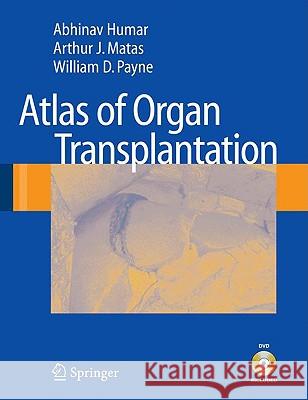 Atlas of Organ Transplantation [With DVD] Humar, Abhinav 9781848009141