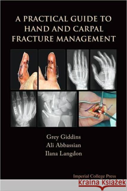 A Practical Guide to Hand and Carpal Fracture Management Giddins, Grey 9781848162617 0