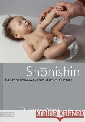 Shonishin: The Art of Non-Invasive Paediatric Acupuncture Oppenheimer, Anne 9781848191600 Singing Dragon