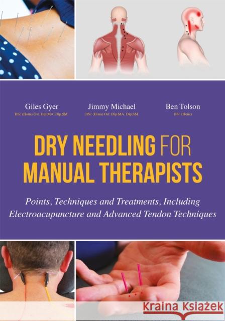 Dry Needling for Manual Therapists: Points, Techniques and Treatments, Including Electroacupuncture and Advanced Tendon Techniques Giles Gyer 9781848192553 Jessica Kingsley Publishers