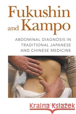 Fukushin and Kampo: Abdominal Diagnosis in Traditional Japanese and Chinese Medicine Nigel Dawes Kenji Watanabe 9781848193673