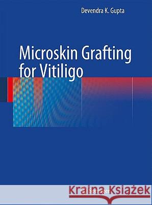 Microskin Grafting for Vitiligo Devendra K. Gupta 9781848826045 Springer