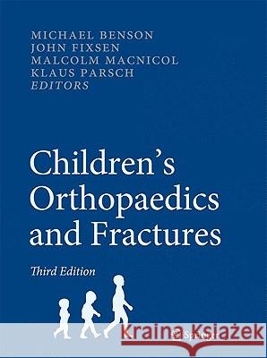 Children's Orthopaedics and Fractures Michael Benson John Fixsen Malcolm MacNicol 9781848826106 Springer