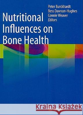 Nutritional Influences on Bone Health Peter Burckhardt Bess Dawson-Hughes Connie Weaver 9781848829770 Not Avail