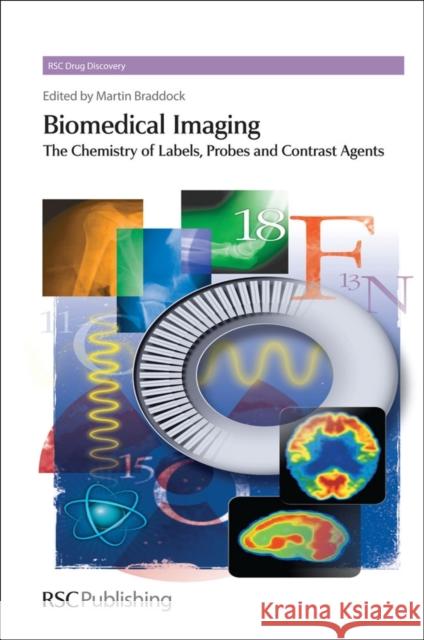 Biomedical Imaging: The Chemistry of Labels, Probes and Contrast Agents Braddock, Martin 9781849730143 0