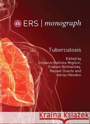 Tuberculosis Giovanni Battista Migliori Graham Bothamley Raquel Duarte 9781849840996 European Respiratory Society