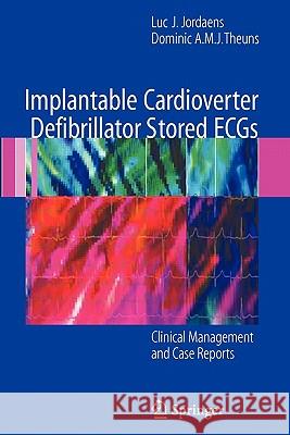 Implantable Cardioverter Defibrillator Stored ECGs: Clinical Management and Case Reports Luc J. Jordaens, Dominic A.M.J. Theuns 9781849966405 Springer London Ltd