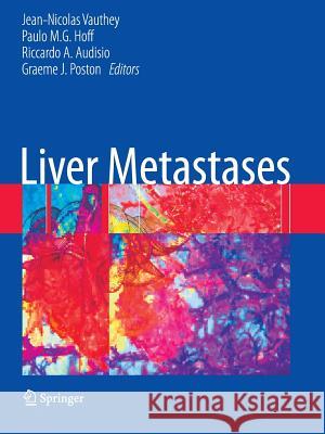 Liver Metastases Paulo M. G. Hoff Riccardo A. Audisio Graeme J. Poston 9781849966849 Springer