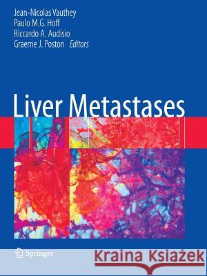 Liver Metastases Paulo M. G. Hoff Riccardo A. Audisio Graeme J. Poston 9781849966849