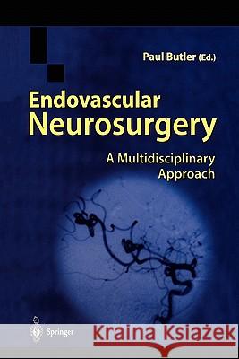 Endovascular Neurosurgery: A Multidisciplinary Approach Butler, Paul 9781849968904 Springer