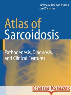 Atlas of Sarcoidosis: Pathogenesis, Diagnosis and Clinical Features Mihailovic-Vucinic, Violeta 9781849969253 Not Avail