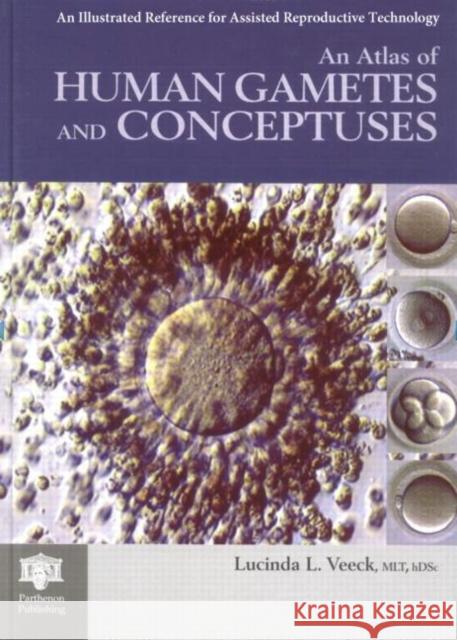 An Atlas of Human Gametes and Conceptuses: An Illustrated Reference for Assisted Reproductive Technology Veeck, Lucinda L. 9781850700166 Taylor & Francis Group