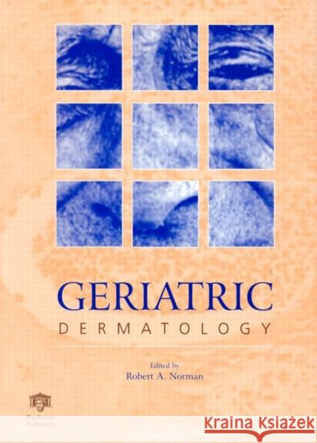 Geriatric Dermatology Robert A. Norman 9781850703112 Taylor & Francis Group