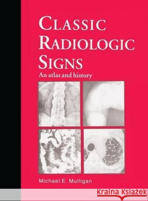 Classic Radiologic Signs: An Atlas and History Mulligan, M. E. 9781850706649 Taylor & Francis Group