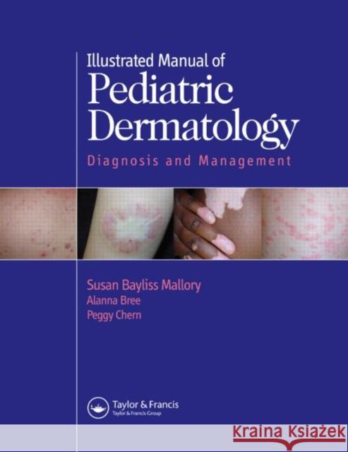 Illustrated Manual of Pediatric Dermatology: Diagnosis and Management Chern, Peggy 9781850707530 Taylor & Francis Group