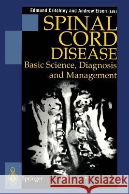 Spinal Cord Disease: Basic Science, Diagnosis and Management Critchley, Edmund 9781852331214 Springer