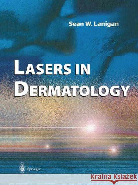 Lasers in Dermatology Sean Lanigan 9781852332778 Springer