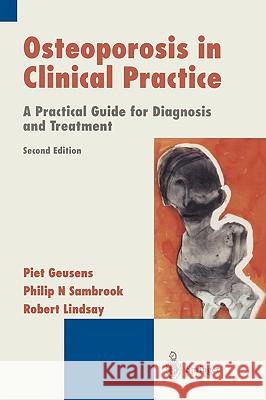Osteoporosis in Clinical Practice: A Practical Guide for Diagnosis and Treatment Geusens, Piet 9781852337575 SPRINGER-VERLAG LONDON LTD