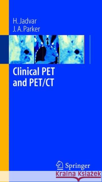 Clinical Pet and Pet/CT H. Jadvar J. A. Parker 9781852338381 Springer