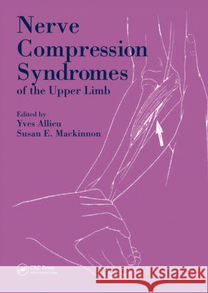 Nerve Compression Syndromes of the Upper Limb Yves Allieu Susan E. MacKinnon Allieu Allieu 9781853176098 Taylor & Francis Group