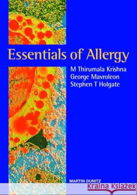 Essentials of Allergy M. Thirumala Krishna George Mavroleon Stephen T. Holgate 9781853177835 Taylor & Francis Group
