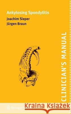 Clinician's Manual on Ankylosing Spondylitis Joachim Sieper J. Rgen Braun 9781858734361 Springer Healthcare