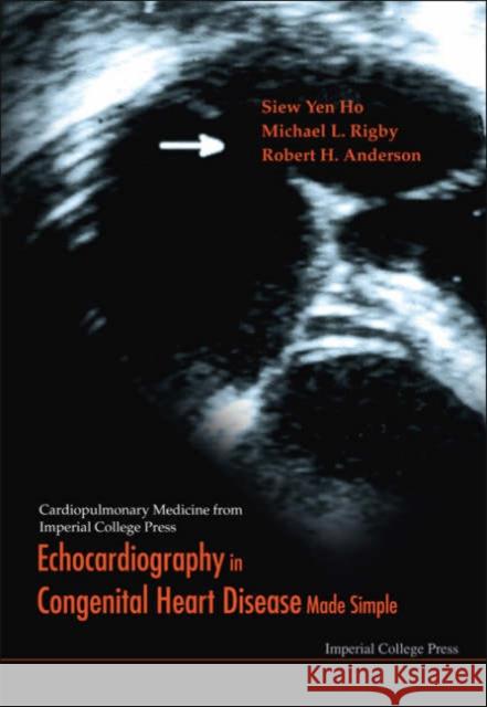 Echocardiography in Congenital Heart Disease Made Simple Anderson, Robert Henry 9781860941245