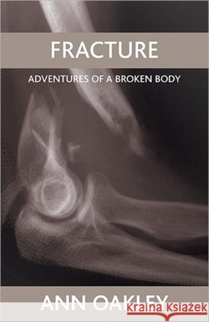 Fracture: Adventures of a Broken Body Oakley, Ann 9781861349378 0