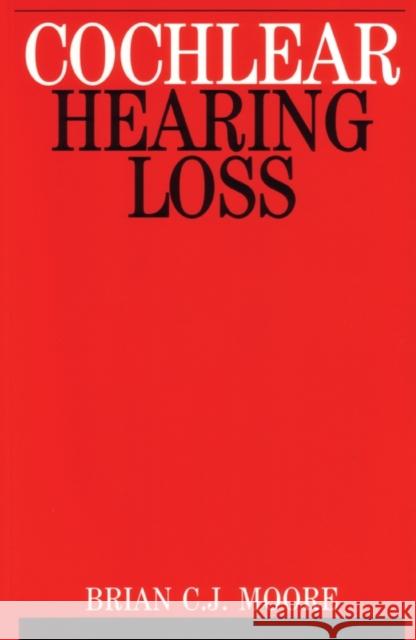 Cochlear Hearing Loss Brian C. J. Moore 9781861560919 John Wiley & Sons