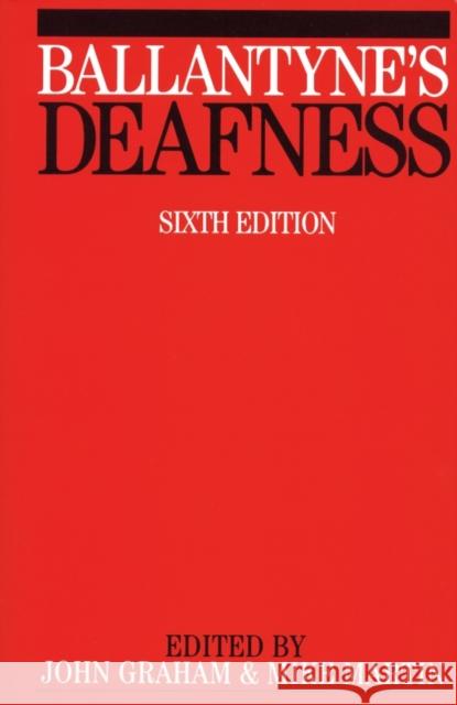 Ballantyne s Deafness 6e Graham, John 9781861561701 John Wiley & Sons